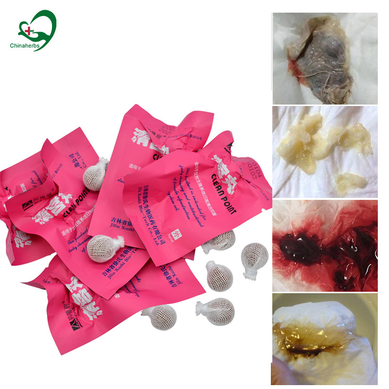 20pcs Yoni Pearls Clean Point  - Medical Wellness & Spa Werona review and price
